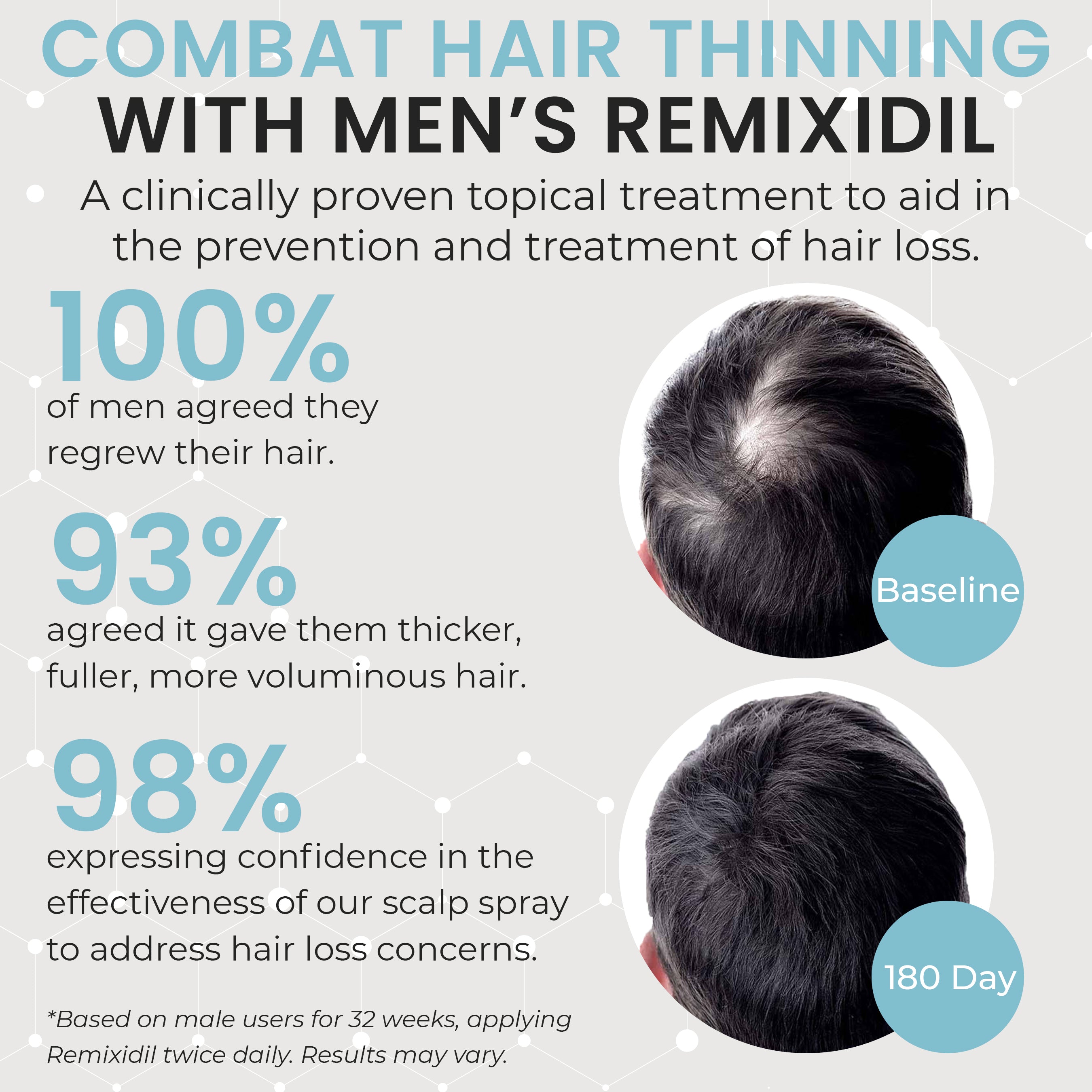 Remixidil Men's 5% Minoxidil Scalp Spray