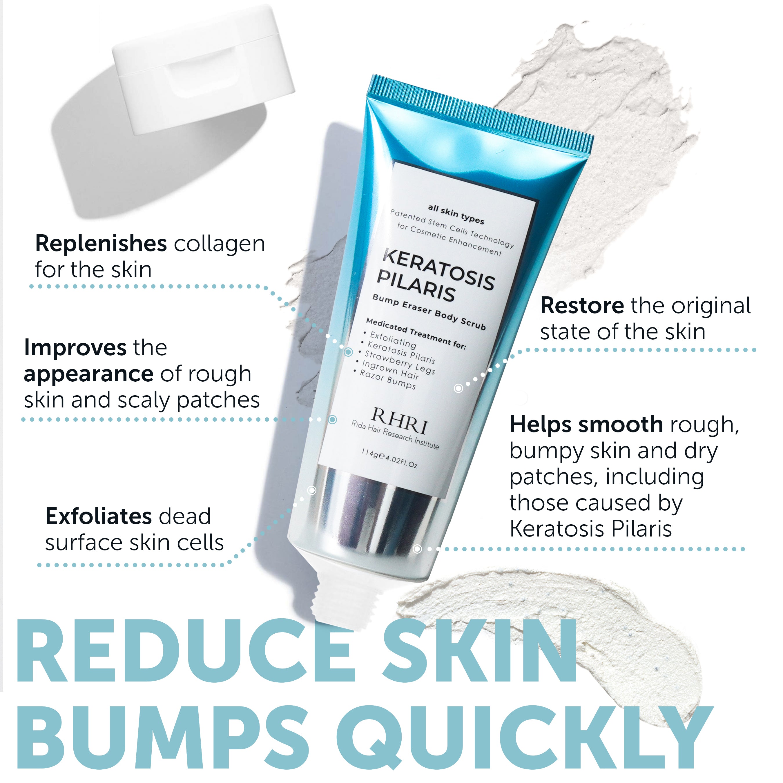 KP Bump Eraser Body Scrub