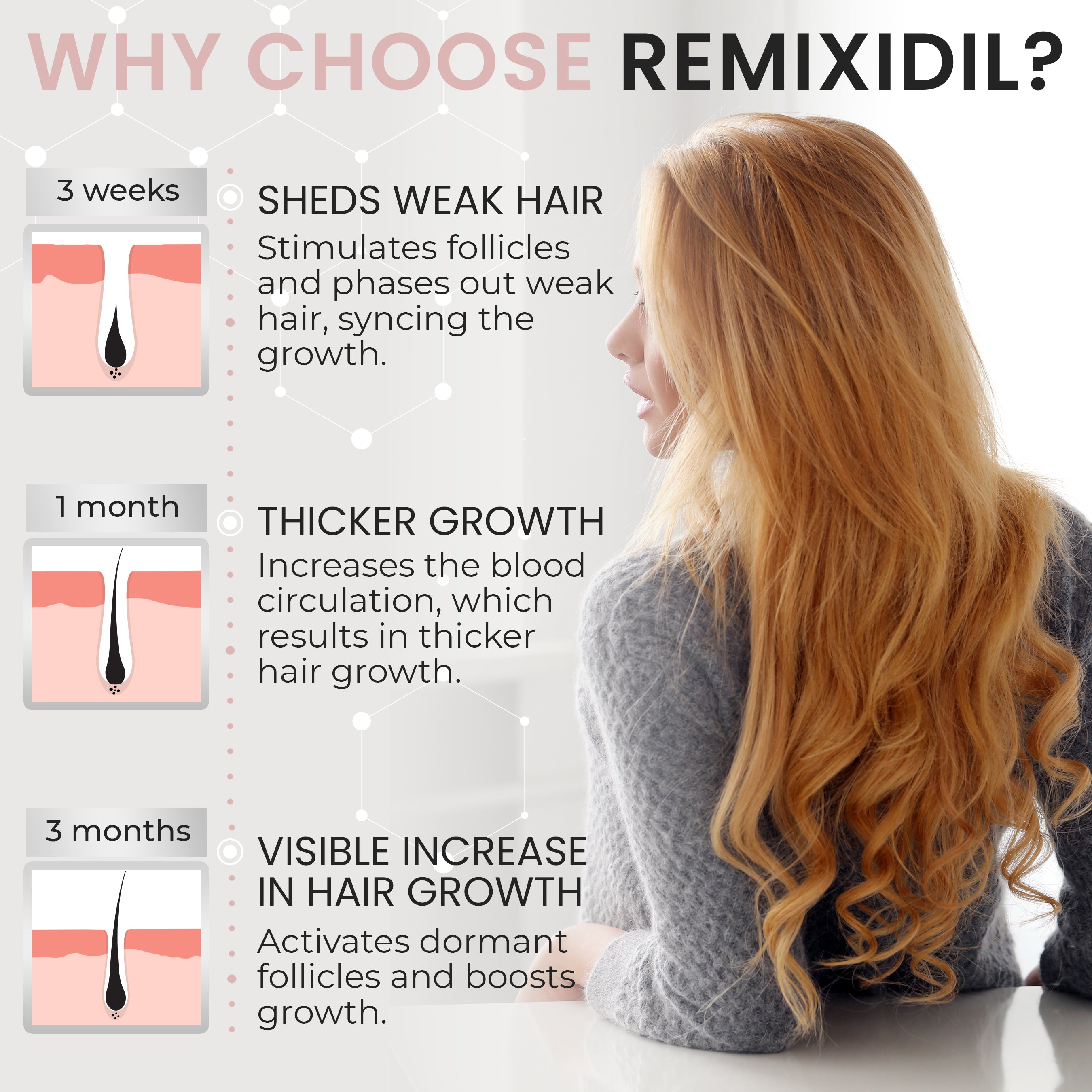 Remixidil Women's 2% Minoxidil Scalp Spray