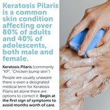 Body Soap Scrub with 10% AHA & Micro Pumice Beads for Keratosis Pilaris 4.2 oz (860012882199)