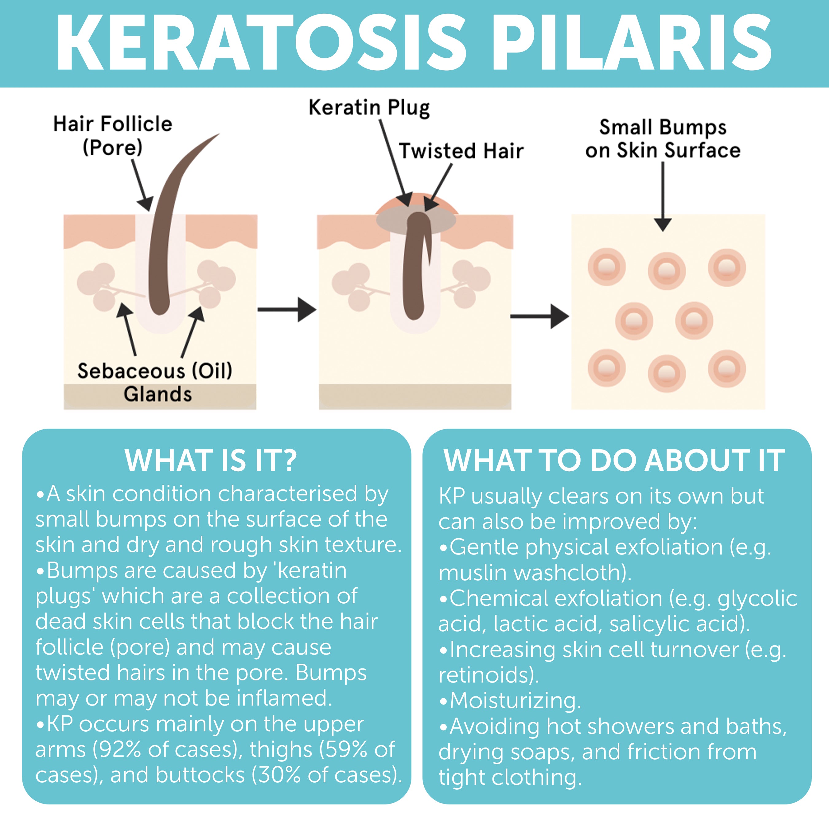 Body Soap Scrub with 10% AHA & Micro Pumice Beads for Keratosis Pilaris 4.2 oz (860012882199)