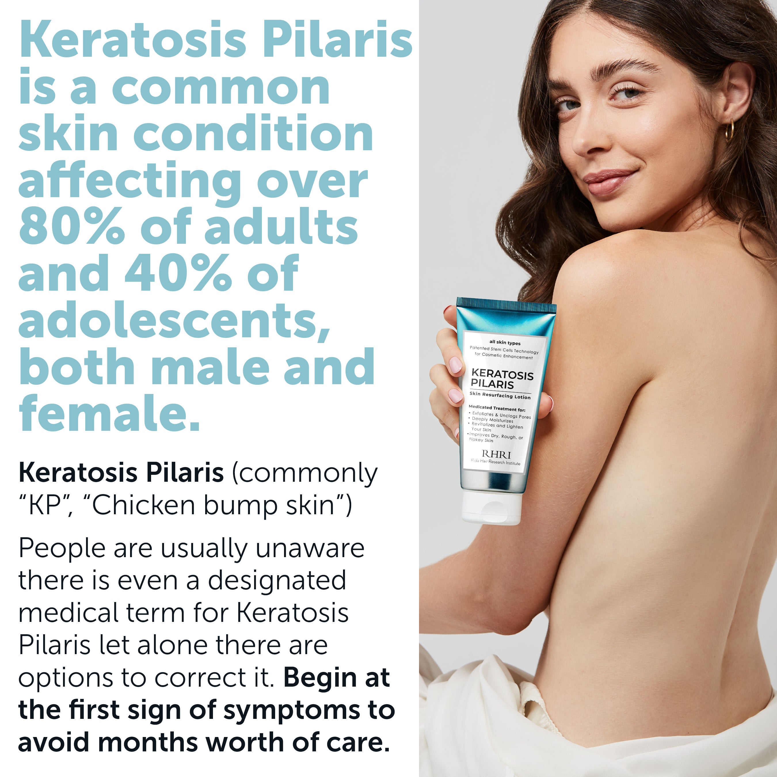 Keratosis Pilaris Lotion