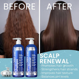 Apple Cider Vinegar Shampoo and Conditioner Set