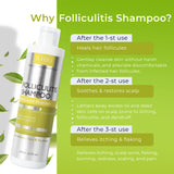 Folliculitis Shampoo with Scalp Massager Brush