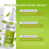 Folliculitis Scalp Spray