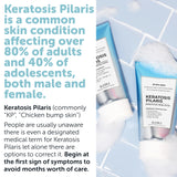 Keratosis Pilaris Bump Eraser Body Scrub + Lotion Set