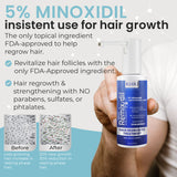 Remixidil Men's 5% Minoxidil Scalp Spray