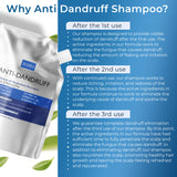 Anti-Dandruff Mens Shampoo Refill