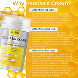 Psoriasis Scalp, Face & Body Cream