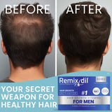 Hair Growth Vitamins for Men