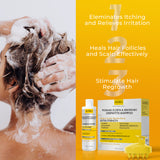 Psoriasis Shampoo