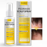 Psoriasis Scalp Spray for Itching, Flaking, and Inflammation