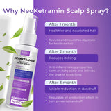 Neoketramin Scalp Spray